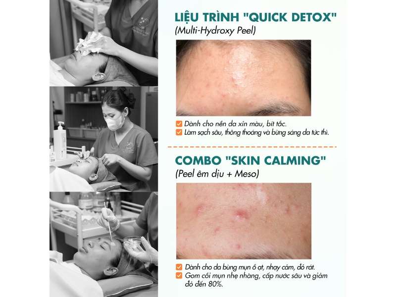 phòng khám dr. choice clinic mang đến giải pháp tái tạo da căng bóng