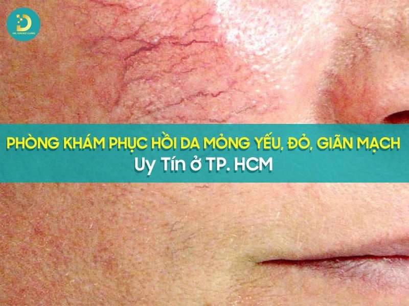 Phòng khám phục hồi da mỏng yếu, đỏ, giãn mạch