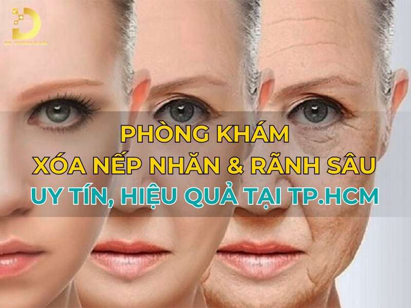 Phòng khám xóa nếp nhăn & rãnh sâu uy tín
