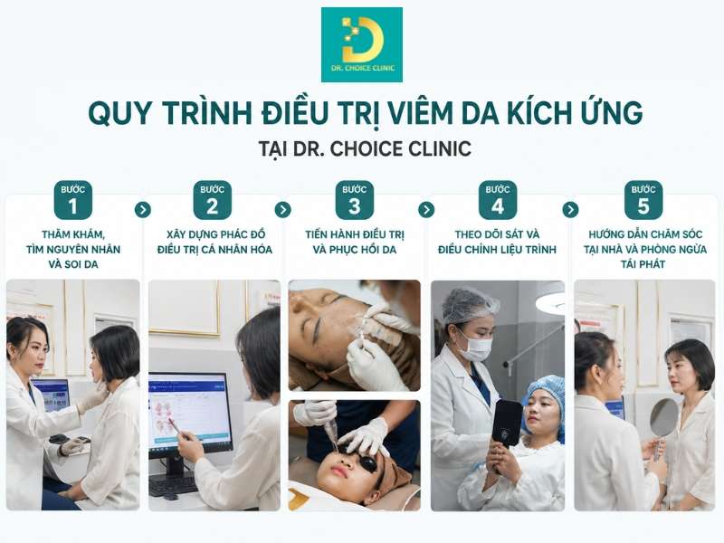 Quy trình điều trị viêm da kích ứng tại Dr. Choice Clinic diễn ra như thế nào?