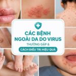 Tìm hiểu các bệnh ngoài da do virus
