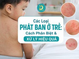Tìm hiểu các loại bệnh phát ban ở trẻ em