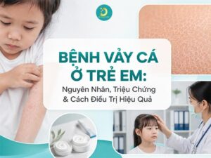 Tìm hiểu bệnh vảy cá ở trẻ em