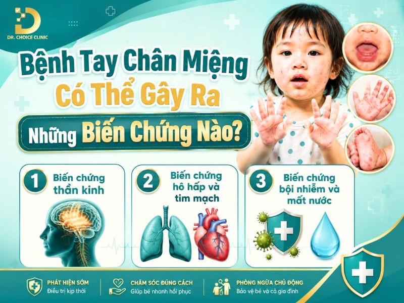 Bệnh Tay Chân Miệng Ở Trẻ: Nguyên Nhân, Dấu Hiệu, Cách Phòng Ngừa Và Điều Trị 13 Biến chứng của bệnh tay chân miệng ở trẻ