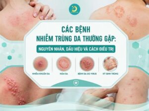 Các bệnh nhiễm trùng da thường gặp