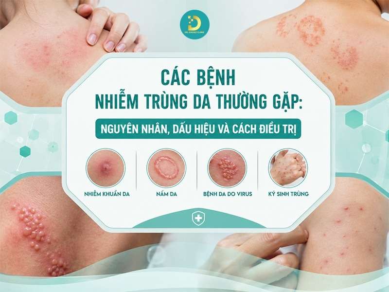 Các bệnh nhiễm trùng da thường gặp