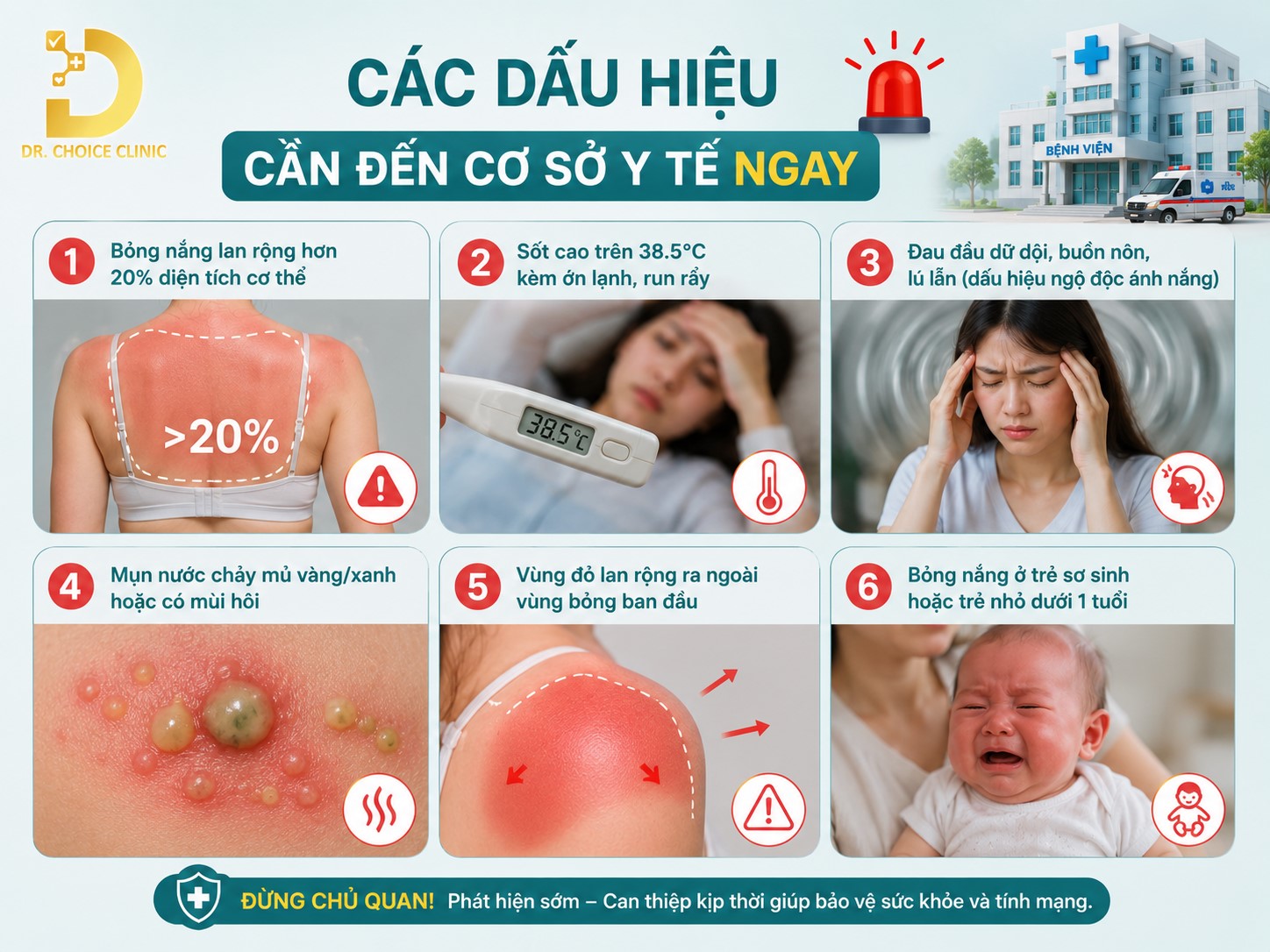 Bỏng Nắng Là Gì? Nguyên Nhân, Triệu Chứng & Cách Điều Trị Hiệu Quả 14 Cần liên hệ cơ sở y tế khi vùng bỏng nắng lan rộng, chiếm hơn 20% diện tích cơ thể