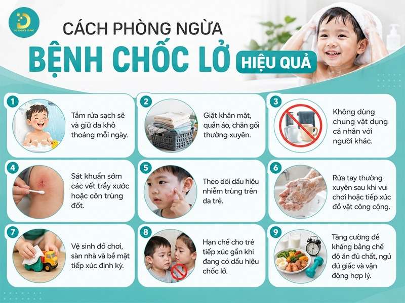 Cách phòng ngừa bệnh chốc lở hiệu quả