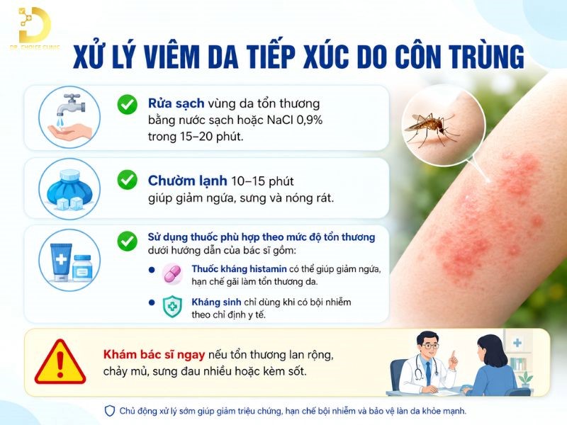 Viêm Da Tiếp Xúc Do Côn Trùng: Triệu Chứng Và Cách Xử Lý Hiệu Quả 11 Cách xử lý khi bị viêm da tiếp xúc côn trùng