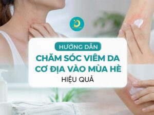 Hướng dẫn chăm sóc viêm da cơ địa vào mùa hè