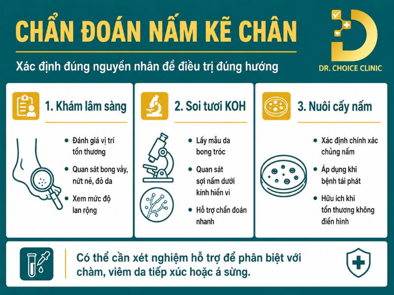 Nấm Kẽ Chân: Nguyên Nhân, Triệu Chứng Và Cách Điều Trị Dứt Điểm 13 Phương pháp chẩn đoán bệnh nấm kẽ chân