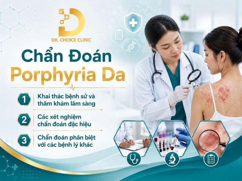 Porphyria Da: Nguyên Nhân, Triệu Chứng, Chẩn Đoán Và Điều Trị 11 Các phương pháp chẩn đoán bệnh porphyria da