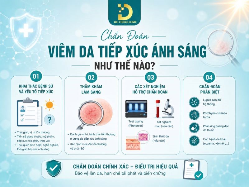 Viêm Da Tiếp Xúc Ánh Sáng: Nguyên Nhân, Triệu Chứng, Chẩn Đoán Và Điều Trị 15 Các phương pháp chẩn đoán viêm da tiếp xúc ánh sáng