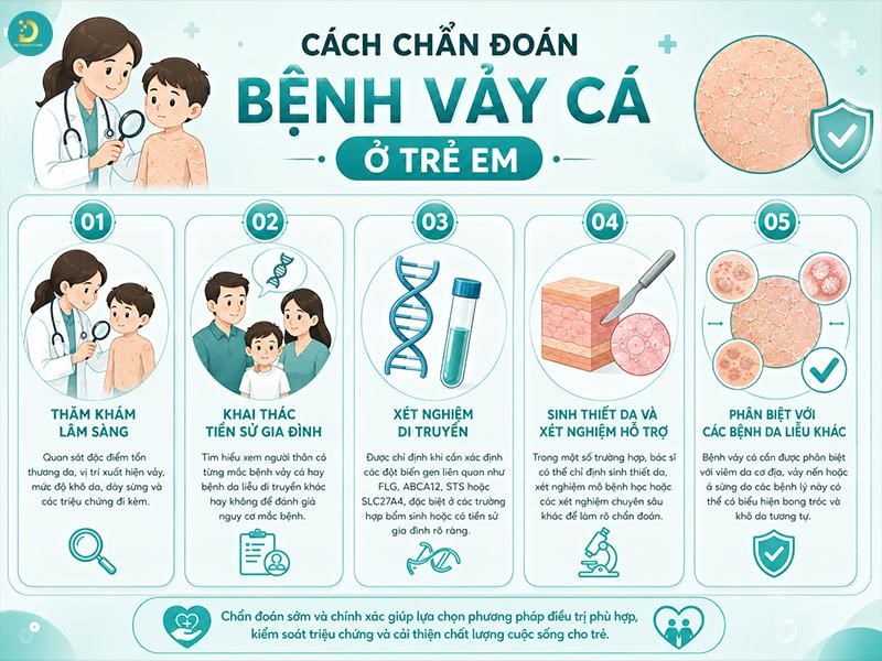 chuan doan benh vay ca tre em
