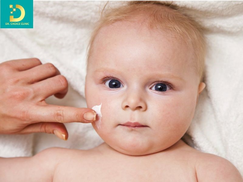 Điều trị viêm da tiếp xúc ở trẻ em