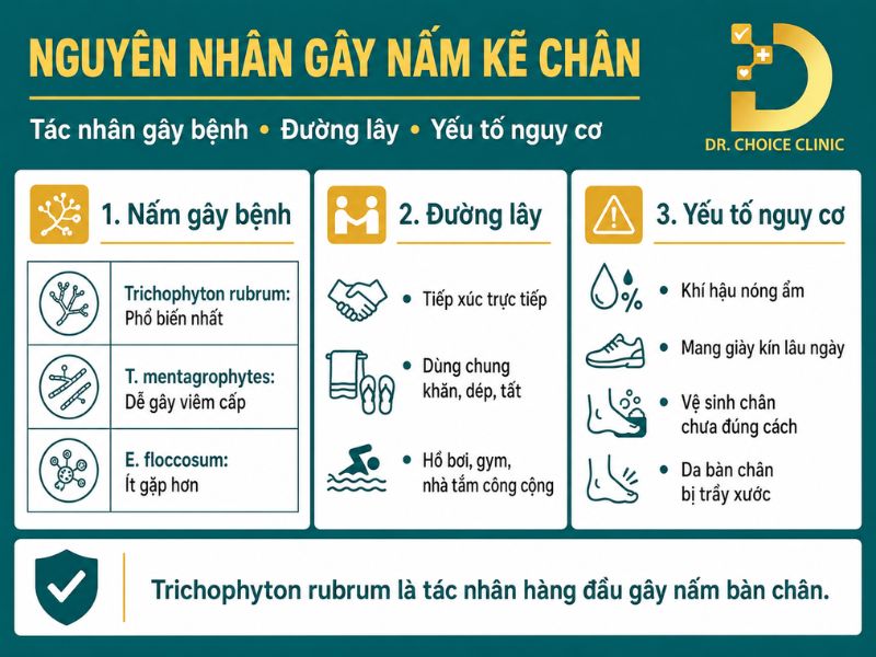 Nấm Kẽ Chân: Nguyên Nhân, Triệu Chứng Và Cách Điều Trị Dứt Điểm 11 Nguyên nhân gây ra bệnh nấm kẽ chân