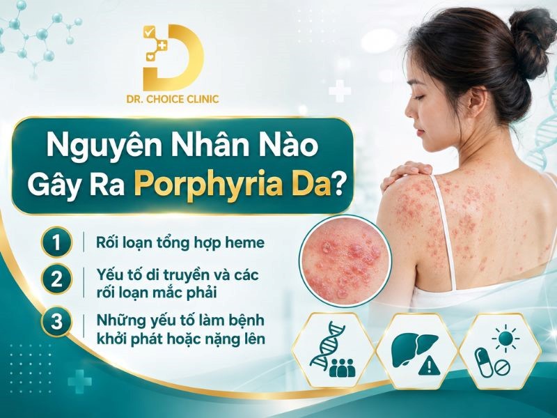Porphyria Da: Nguyên Nhân, Triệu Chứng, Chẩn Đoán Và Điều Trị 9 Những nguyên nhân chính gây ra Porphyria da