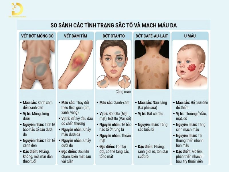 Phân biệt vết bớt mông cổ và các bệnh lý về da khác