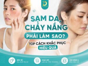 Tìm hiểu về sạm da và cháy nắng: nguyên nhân, cách khắc phục