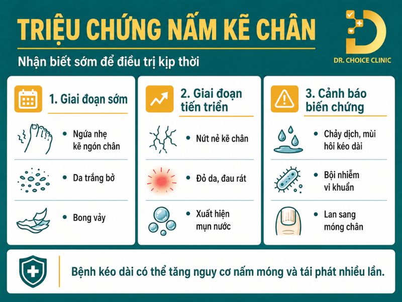 Nấm Kẽ Chân: Nguyên Nhân, Triệu Chứng Và Cách Điều Trị Dứt Điểm 12 Các triệu chứng của bệnh nấm kẽ chân