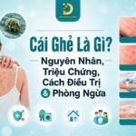 Tìm hiểu về bệnh ghẻ