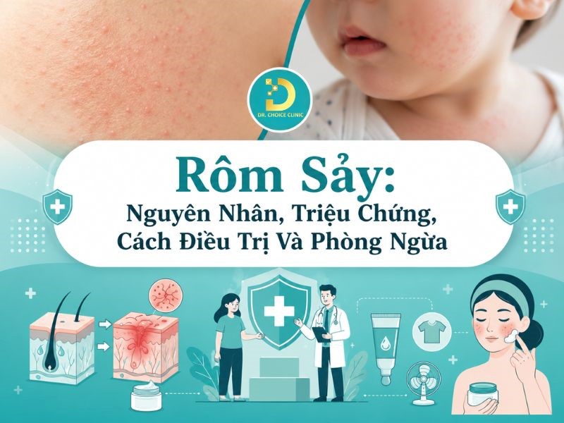 Rôm Sảy: Nguyên Nhân, Triệu Chứng, Cách Điều Trị Và Phòng Ngừa 7 Tìm hiểu bệnh rôm sảy: nguyên nhân, triệu chứng và cách điều trị