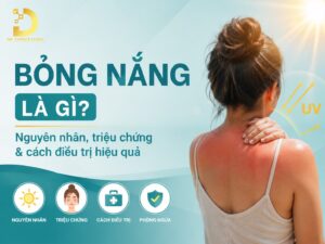 Tìm hiểu tình trạng bỏng nắng: nguyên nhân, cách xử lý