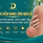 Tìm hiểu chi tiết bệnh viêm nang lông mùa hè