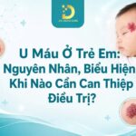 Tìm hiểu bệnh u máu ở trẻ em
