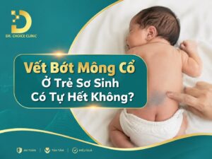 Tìm hiểu về vết bớt mông cổ ở trẻ sơ sinh