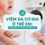 Viêm da cơ địa trẻ em