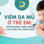 Tìm hiểu về viêm da mủ ở trẻ em