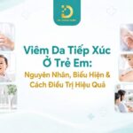 Tìm hiểu viêm da tiếp xúc ở trẻ em