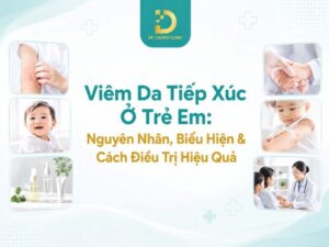 Tìm hiểu viêm da tiếp xúc ở trẻ em