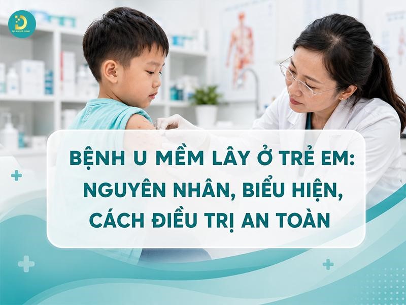 Tìm hiểu bệnh u mềm lây ở trẻ em