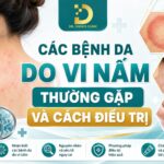 Các bệnh về da do vi nấm thường gặp