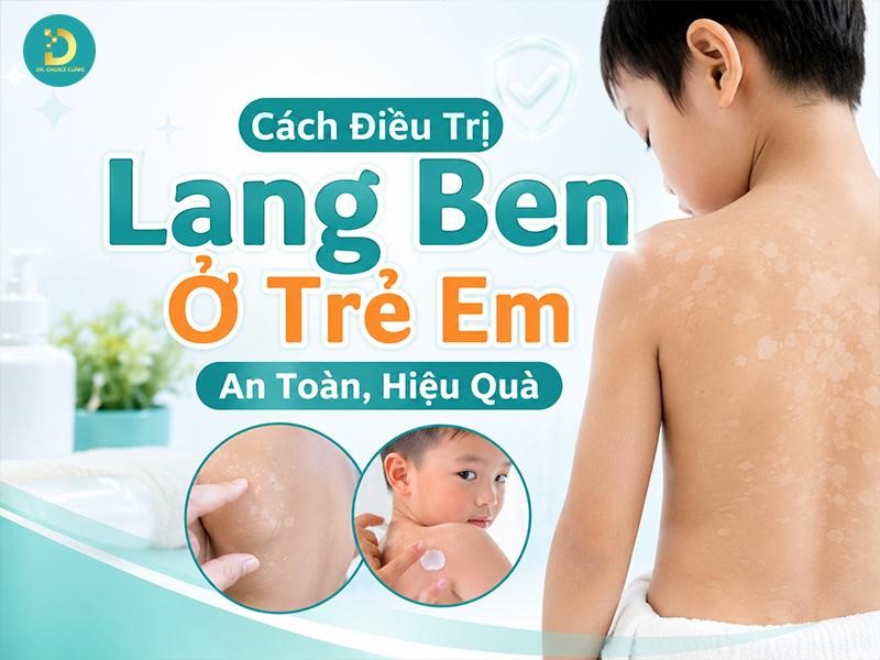 Cách Điều Trị Lang Ben Ở Trẻ Em An Toàn, Hiệu Quả 9 Cách điều trị lang ben ở trẻ em