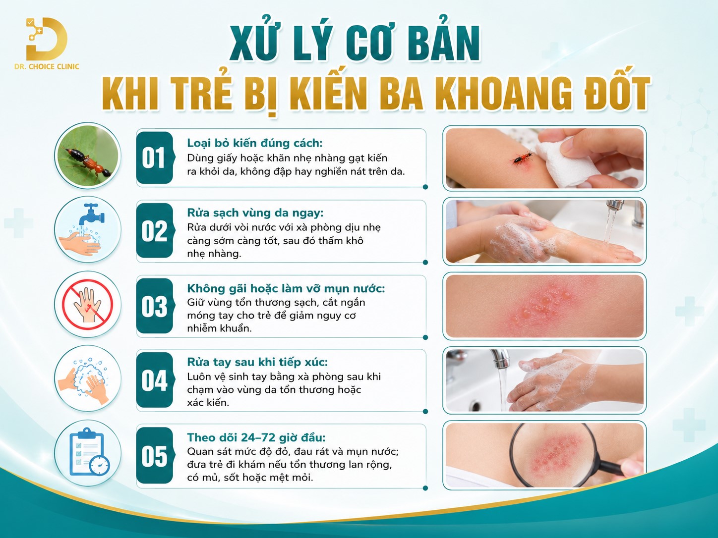 Xử Lý Khi Trẻ Bị Kiến Ba Khoang Đốt Tránh Bị Loét Da 12 Cách xử lý cơ bản khi trẻ bị kiến ba khoang đốt