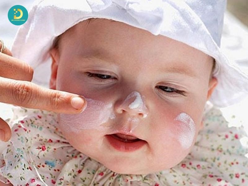 Phân Biệt Chàm Sữa Và Rôm Sảy: Khác Nhau Như Thế Nào? 10 Chăm sóc trẻ bị chàm sữa