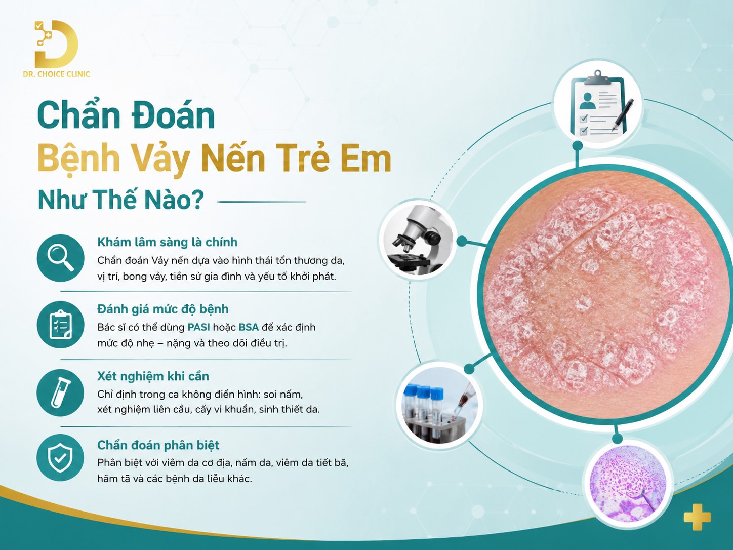 Bệnh Vảy Nến Ở Trẻ Em: Nguyên Nhân, Triệu Chứng, Chẩn Đoán & Điều Trị 12 Chẩn đoán bệnh vảy nến ở trẻ em