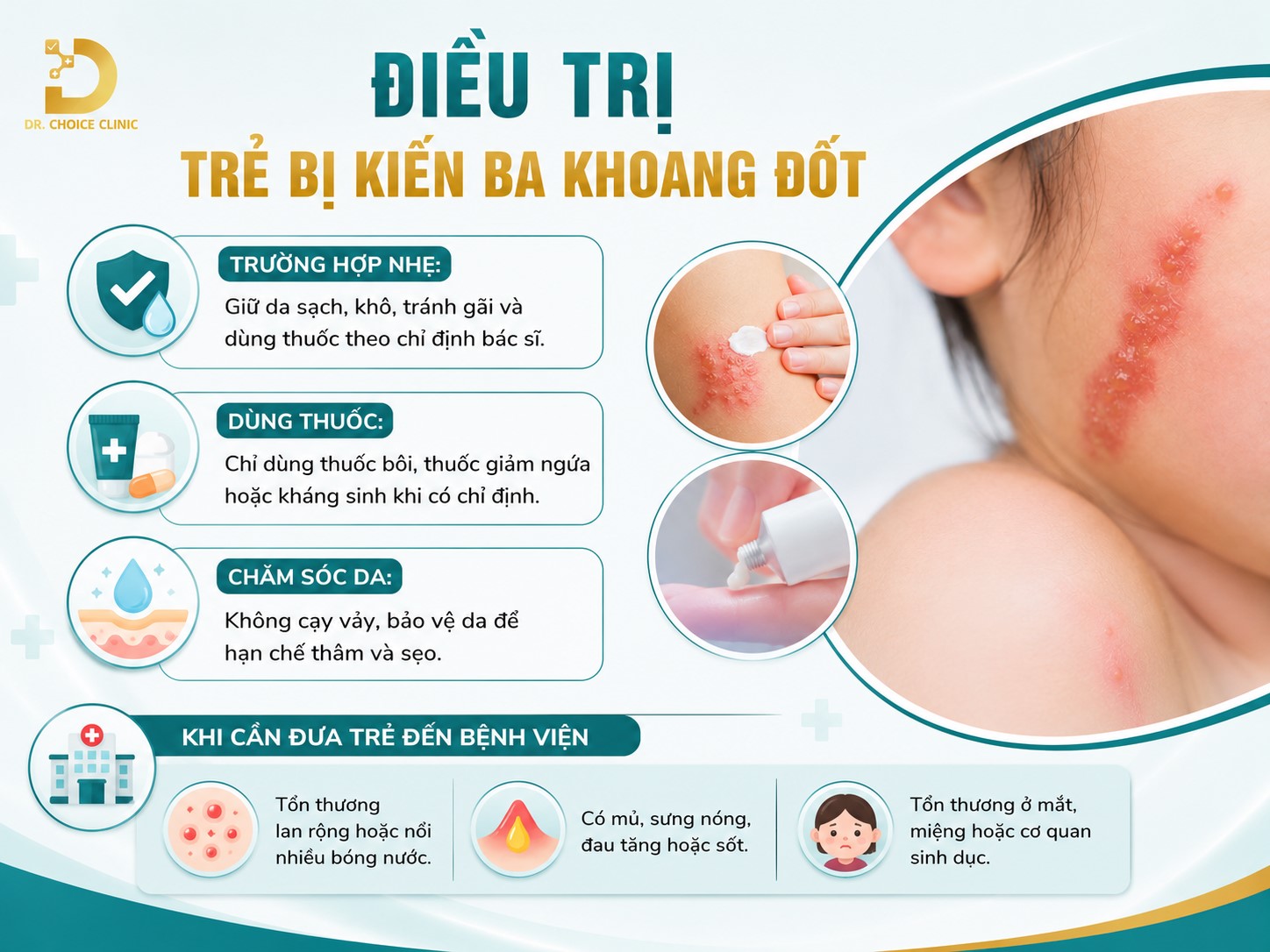 Xử Lý Khi Trẻ Bị Kiến Ba Khoang Đốt Tránh Bị Loét Da 13 Điều trị trẻ bị kiến ba khoang đốt
