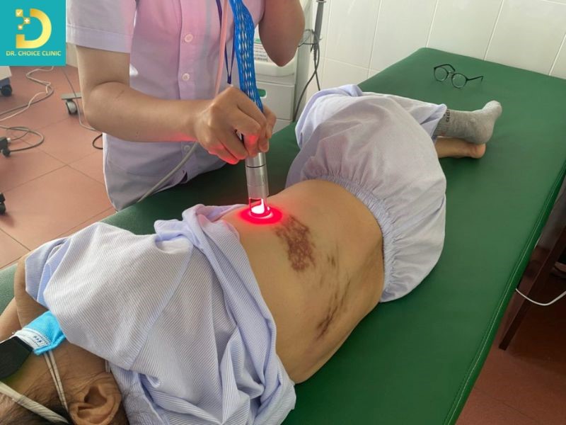 Zona Thần Kinh: Nguyên Nhân, Triệu Chứng, Cách Điều Trị Và Phòng Ngừa 12 Điều trị zona thần kinh ở cơ sở y tế