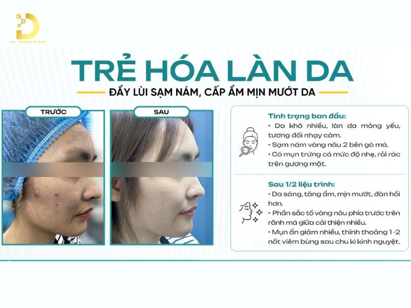 Các Bệnh Về Da Do Ánh Nắng Mặt Trời: Cách Ngăn Ngừa & Điều Trị Hiệu Quả 23 Kết quả trẻ hóa làn da.