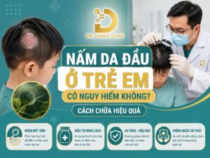 Tìm hiểu về bệnh nấm da đầu ở trẻ em