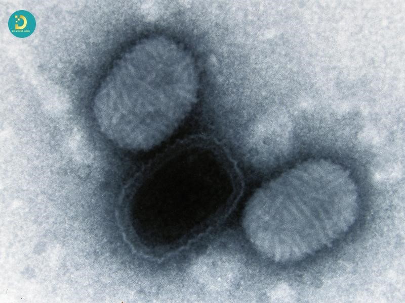 U mềm lây ở trẻ em do virus Molluscum contagiosum (MCV) xâm nhập qua các tổn thương nhỏ trên da