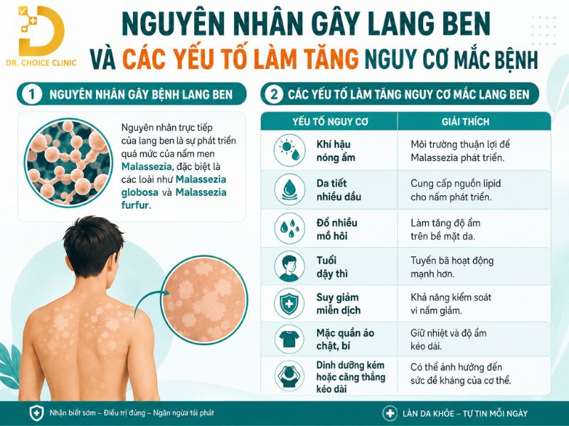 Lang Ben: Nguyên Nhân, Dấu Hiệu & Cách Điều Trị, Phòng Ngừa 12 Nguyên nhân và các yếu tố làm tăng nguy cơ mắc lang ben