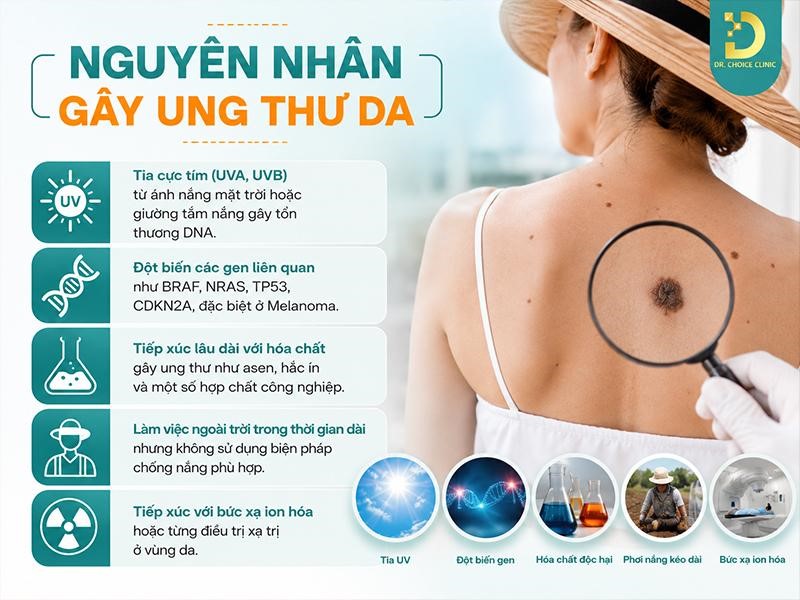 Ung Thư Da: Nguyên Nhân, Triệu Chứng, Chẩn Đoán & Hướng Điều Trị 12 Nguyên nhân gây ra ung thư da