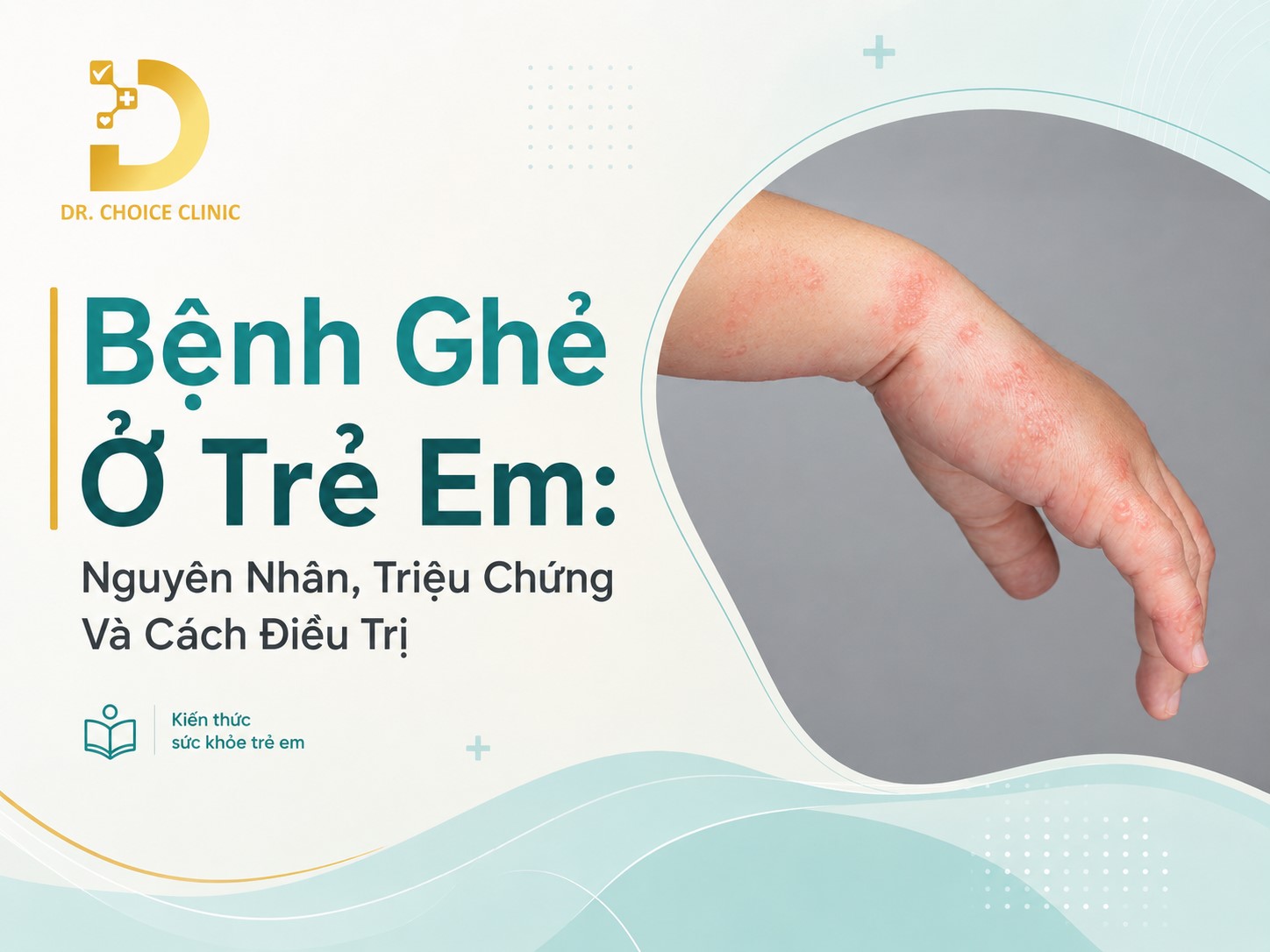Tìm hiểu về bệnh ghẻ ở trẻ em