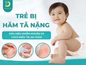 Tìm hiểu trình trạng trẻ bị hăm tả nặng