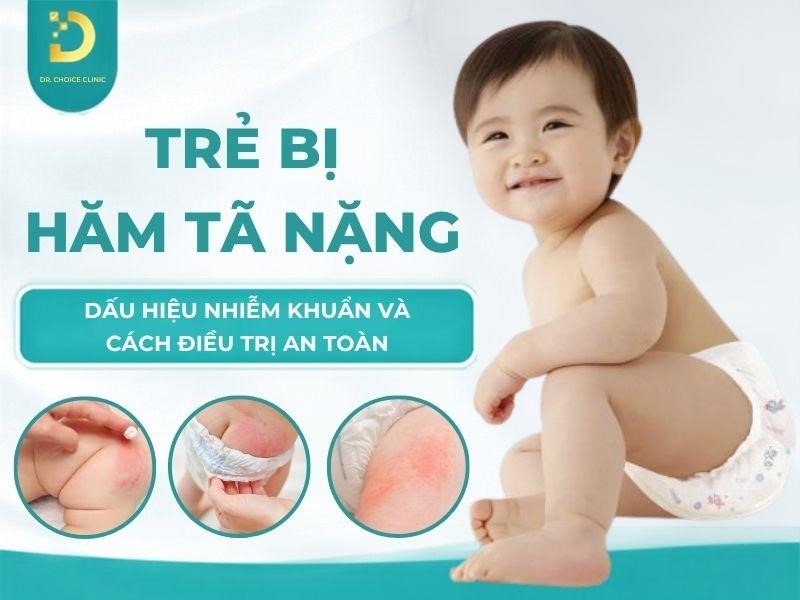 Tìm hiểu trình trạng trẻ bị hăm tả nặng